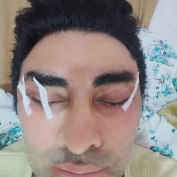 Prof. Dr. Ali Gürlek Estetik Söz Verdiği Yüz Ve Göz Estetik Operasyonlarını Yapmaması