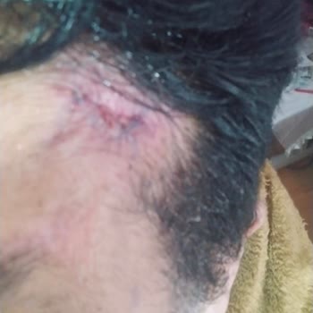 Prof. Dr. Ali Gürlek Estetik Söz Verdiği Yüz Ve Göz Estetik Operasyonlarını Yapmaması