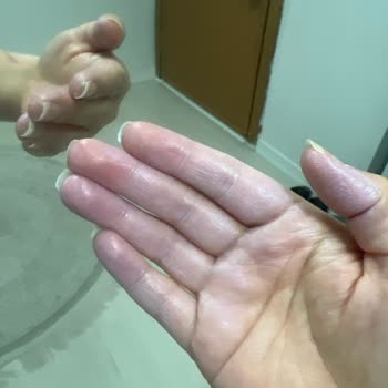 Avene Güneş Kremi Mavi Tonlu Beyaz Tabaka Bırakıyor İade Talebi