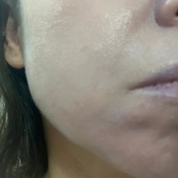 Avene Güneş Kremi Mavi Tonlu Beyaz Tabaka Bırakıyor İade Talebi