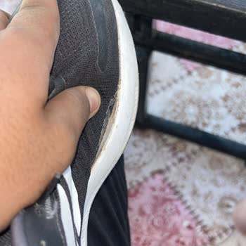 Boyner Iğdır Mağazasında Üretim Hatası Olarak Deforme Olan Ayakkabının Değişim Talebi Reddedildi