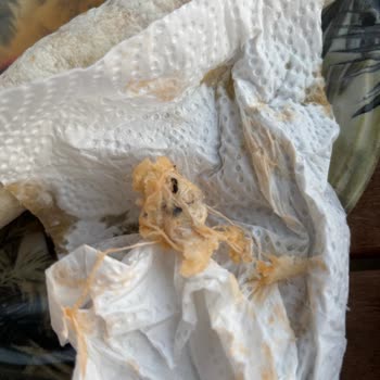 Trendyolgo'dan Gelen Dönerde Yabancı Madde Bulunması Ve İade Talebi