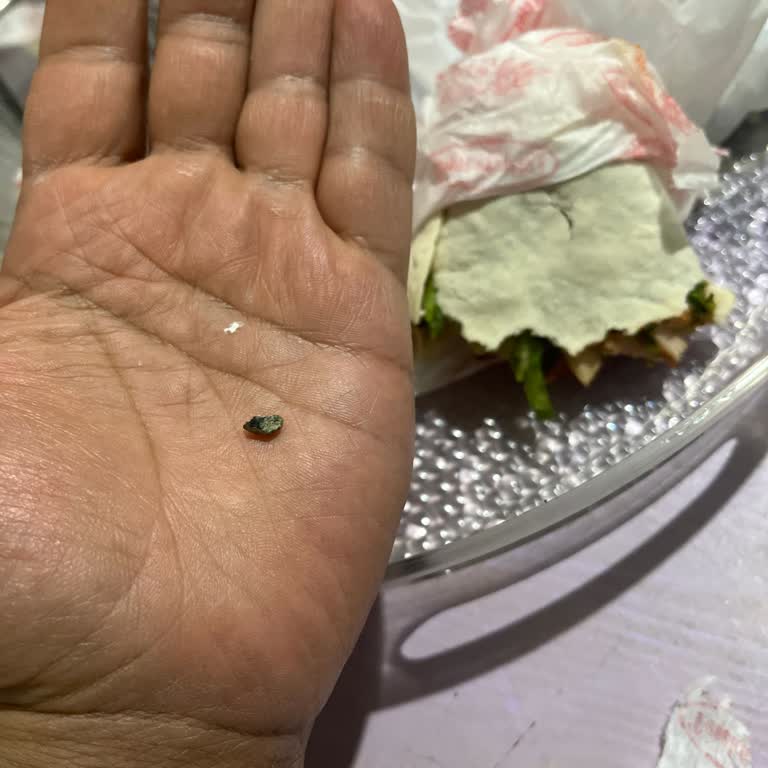 Yemeksepeti Dürümdeki Taş Parçası Dişimi Kırdı ve Sağlık Sorunu Yaratıyor