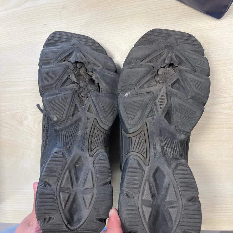 Skechers Ayakkabısının Üretim Hatası Nedeniyle Garantinin Haksız Reddi