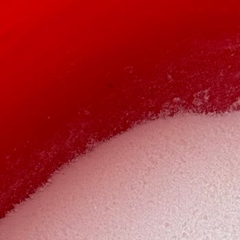 Dr. Oetker Krem Şanti Ürünün İçinde Böcek Keşfi Ve A101’in Yetersiz Yanıtı