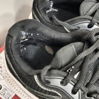 Skechers Ayakkabısında İç Topuk Çökmesi Ve Kullanıcı Hatası Reddi