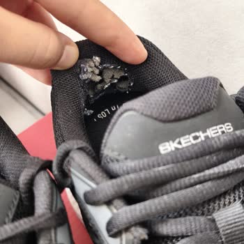 Skechers Ayakkabısında İç Topuk Çökmesi Ve Kullanıcı Hatası Reddi