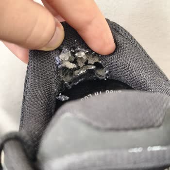 Skechers Ayakkabısında İç Topuk Çökmesi Ve Kullanıcı Hatası Reddi