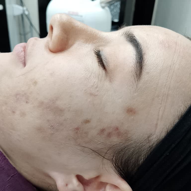 Yanıltıcı Sözler, Etkisiz Tedavi Ve 6000 TL İade Talebi