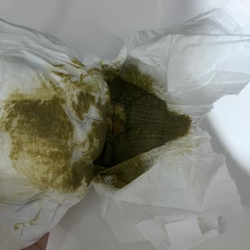 Ebebek Aptamil Prosyneo İle Bebekte Aşırı Kokulu Ve Koyu Yeşil İshal