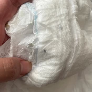 Molfix Bebek Bezinde Yabancı Madde Ve Siyah Leke