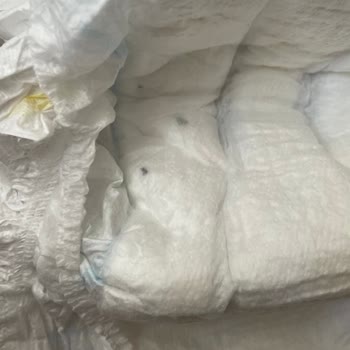 Molfix Bebek Bezinde Yabancı Madde Ve Siyah Leke