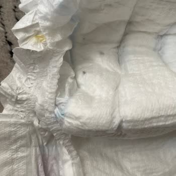 Molfix Bebek Bezinde Yabancı Madde Ve Siyah Leke
