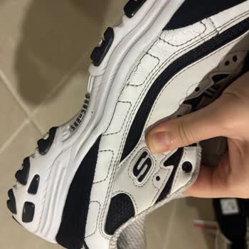 Skechers Çatlayan Ayakkabı İçin Garanti Reddedildi
