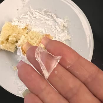 Çıtır Fırın (Denizli) Çıkan Cam Parçası Çocuğu Hayati Risk Altına Soktu