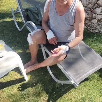 Royal Asarlık Beach Otelinde Araç Çarpması Ve Sorumluluk Reddi
