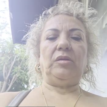 Alfemo Sehpa Bacağı Kırık Yani Kırık Getirildi Bana!