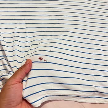 Bir Saatte Delinen Tişörtüm Hatalı Sayılmadı Ve Değişim Reddiyle Karşılaştım