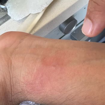 Arçelik Cam Ocak Patlaması: Güvenlik İhlali Ve Ücretsiz Değişim Talebi
