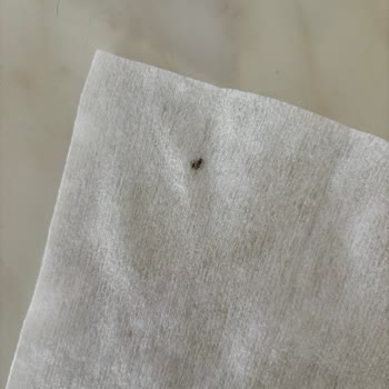 Bebek Islak Mendilinde Böcek Ve Sağlık Riski, Eksik İade Şikayeti