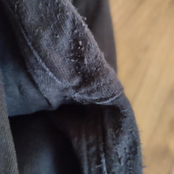 Mavi Mağazasından Aldığım Kot Pantolonun Erime Ve Tüylenme Sorunu