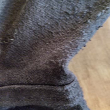 Mavi Mağazasından Aldığım Kot Pantolonun Erime Ve Tüylenme Sorunu