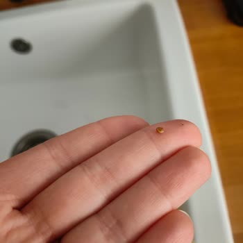 Fıstıkkıran Antep Fıstığı Ezmesinde Kabuğu Bulunması Diş Sağlığını Tehlikeye Atıyor
