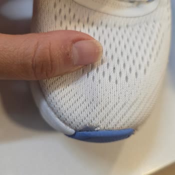 Skechers Ayakkabımda Kısa Sürede Üretim Hatası Ve Garanti Reddi