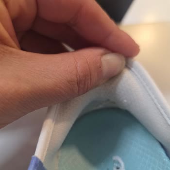 Skechers Ayakkabımda Kısa Sürede Üretim Hatası Ve Garanti Reddi