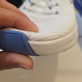 Skechers Ayakkabımda Kısa Sürede Üretim Hatası Ve Garanti Reddi