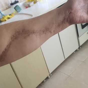 Bulaşık Makinesinin Tekrarlayan Düğüm Arızası Ve Değişim Talebi