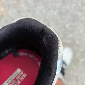 Skechers Ayakkabısında İç Astar Yırtılması Ve İade Reddi