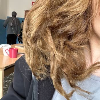 Saçlarım Yanıp Kesildi, Ücret İki Kat, Şok Mağduriyet