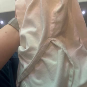 Az Kullanımda Sökük Tişört Şikayeti Ve Değişim Talebi