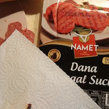 Namet Dana Sucugunda Sakatat Benzeri Yabancı Madde