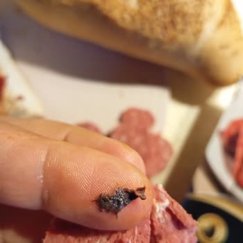 Namet Dana Sucugunda Sakatat Benzeri Yabancı Madde