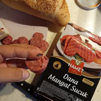 Namet Dana Sucugunda Sakatat Benzeri Yabancı Madde