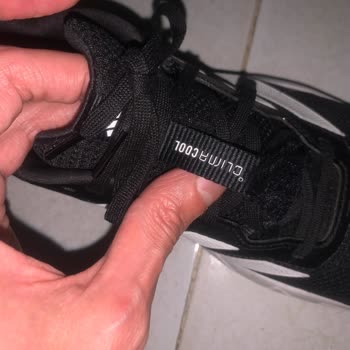 Adidas Ayakkabısındaki Kalite Problemi Ve Mağazanın Kullanıcı Hatası İddiası