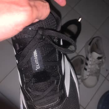 Adidas Ayakkabısındaki Kalite Problemi Ve Mağazanın Kullanıcı Hatası İddiası