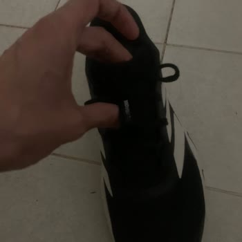 Adidas Ayakkabısındaki Kalite Problemi Ve Mağazanın Kullanıcı Hatası İddiası