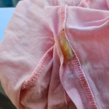 Erimeyen Kapsül Ve Cevapsız Müşteri Hizmetleri Sebebiyle Tişörtüm Mahvoldu
