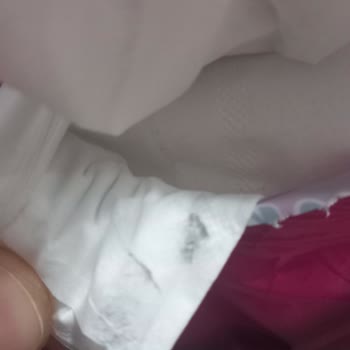 Papia Platinum Kuru Peçetelerde Kapkara Lekeler Ve Hijyen Sorunu
