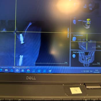 Sağlık Bakanlığı Yanlış Implant Uygulaması Sonrası Hekim Soruşturma Ve Yeniden Tedavi Talebi