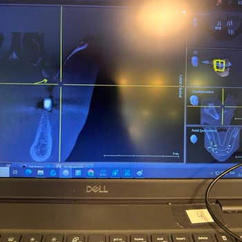 Sağlık Bakanlığı Yanlış Implant Uygulaması Sonrası Hekim Soruşturma Ve Yeniden Tedavi Talebi