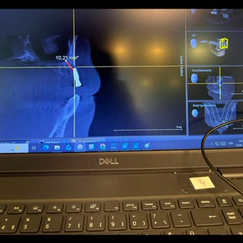 Sağlık Bakanlığı Yanlış Implant Uygulaması Sonrası Hekim Soruşturma Ve Yeniden Tedavi Talebi