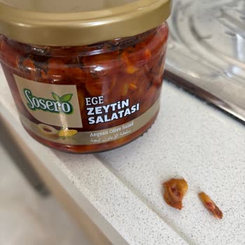 Sosero Zeytin Salatasındaki Çekirdek Nedeniyle Diş Kırılması Ve Tedavi Masrafı Talebi