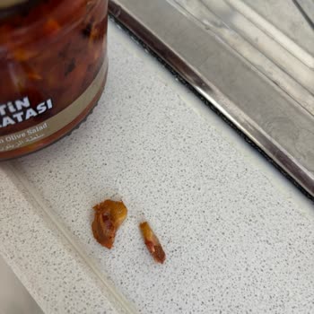 Sosero Zeytin Salatasındaki Çekirdek Nedeniyle Diş Kırılması Ve Tedavi Masrafı Talebi