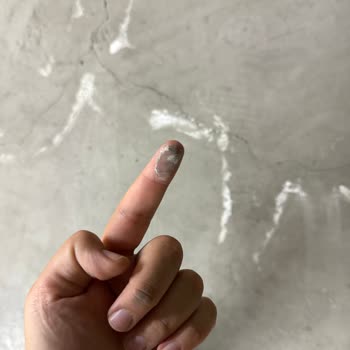 Havuz Sızıntısı Otoparkta Araç Hasarı Oluşturdu, Site Yönetimi Sorumluluğu Reddetti