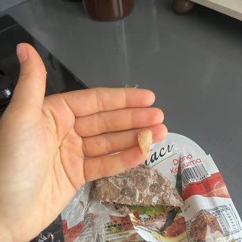 A101 Kavurmasında Kocaman Kemik Parçası: Ağız Ve Diş Yaralanması