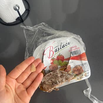 A101 Kavurmasında Kocaman Kemik Parçası: Ağız Ve Diş Yaralanması